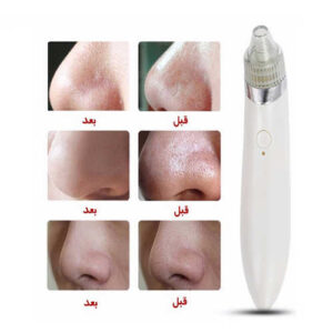 acne cleaner 700 3 300x300 - دستگاه رفع جوش صورت میکرودرم